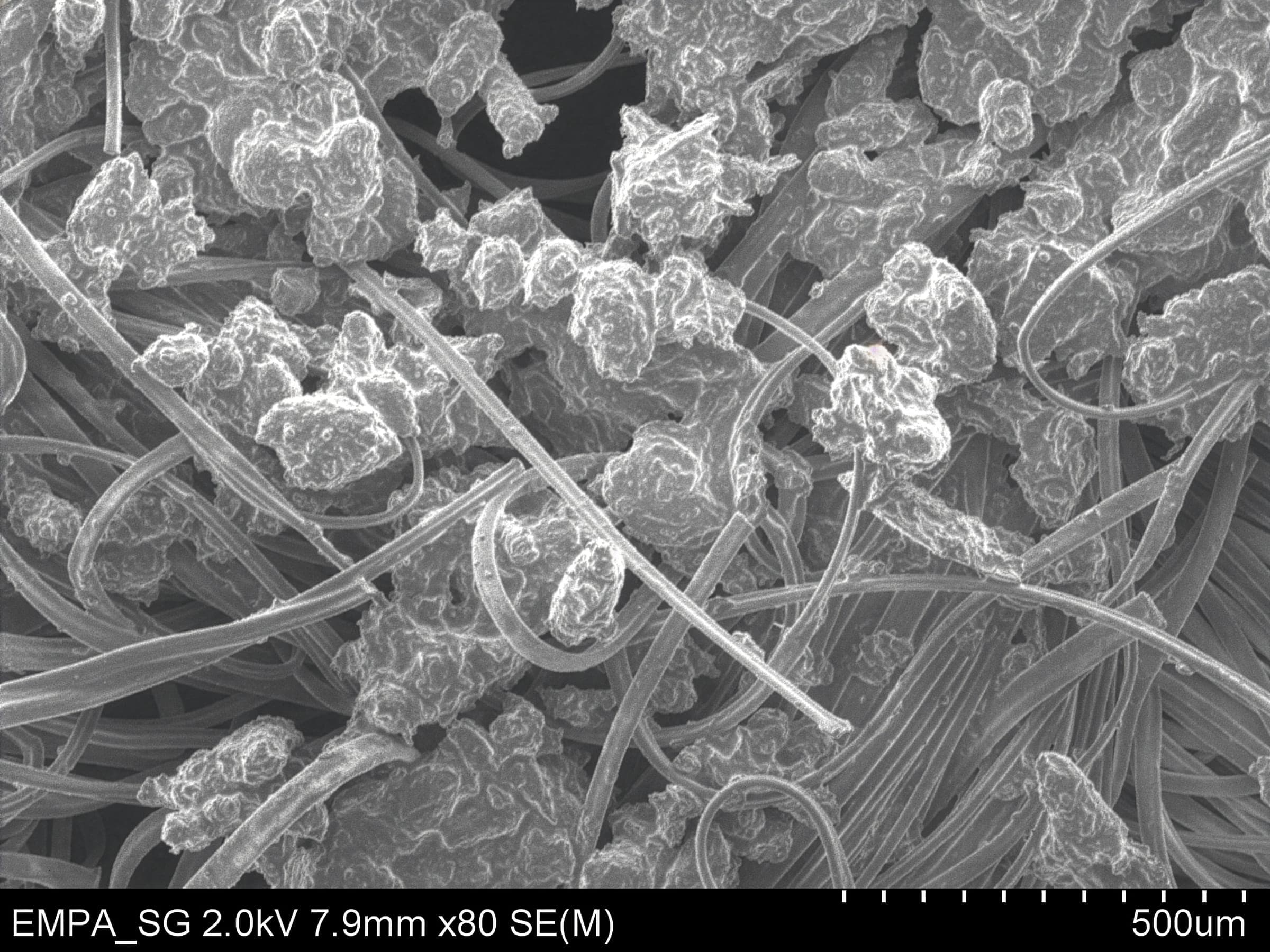 Scanning electron micrograph of textile fibres and debris